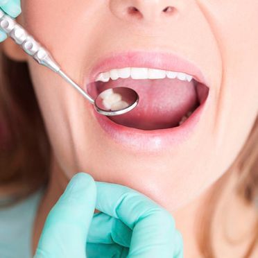 Clínica Dental Errota profesional revisando a paciente